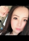 Beautiful eyelids with Hyundai Aesthetics — Korea cost, reviews & before-after | MISOODA