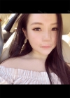 Beautiful eyelids with Hyundai Aesthetics — Korea cost, reviews & before-after | MISOODA