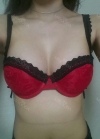 br (t) - 168 50 70 A cup tec 300cc cut / 75d cup after surgery — Korea cost, reviews & before-after | MISOODA