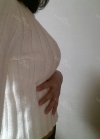 br (t) - 168 50 70 A cup tec 300cc cut / 75d cup after surgery — Korea cost, reviews & before-after | MISOODA
