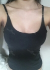 br (t) - 168 50 70 A cup tec 300cc cut / 75d cup after surgery — Korea cost, reviews & before-after | MISOODA