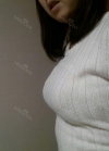 br (t) - 168 50 70 A cup tec 300cc cut / 75d cup after surgery — Korea cost, reviews & before-after | MISOODA