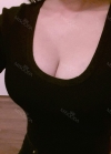 br (t) - 168 50 70 A cup tec 300cc cut / 75d cup after surgery — Korea cost, reviews & before-after | MISOODA