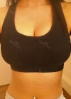 br (t) - 168 50 70 A cup tec 300cc cut / 75d cup after surgery — Korea cost, reviews & before-after | MISOODA