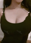 br (t) - 168 50 70 A cup tec 300cc cut / 75d cup after surgery — Korea cost, reviews & before-after | MISOODA