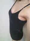 br (t) - 168 50 70 A cup tec 300cc cut / 75d cup after surgery — Korea cost, reviews & before-after | MISOODA