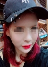 I did rehab surgery on my nose. — Korea cost, reviews & before-after | MISOODA