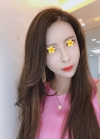 I did rehab surgery on my nose. — Korea cost, reviews & before-after | MISOODA