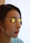 I did rehab surgery on my nose. — Korea cost, reviews & before-after | MISOODA