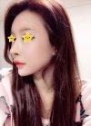 I did rehab surgery on my nose. — Korea cost, reviews & before-after | MISOODA