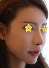 I did rehab surgery on my nose. — Korea cost, reviews & before-after | MISOODA