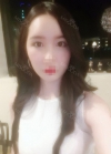 fat graft + nonincisional NI ptosis correction — Korea cost, reviews & before-after | MISOODA