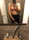Arm Liposuction with Pretty Body Clinic — Korea cost, reviews & before-after | MISOODA