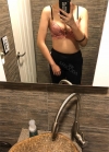 Arm Liposuction with Pretty Body Clinic — Korea cost, reviews & before-after | MISOODA