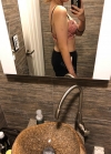 Arm Liposuction with Pretty Body Clinic — Korea cost, reviews & before-after | MISOODA