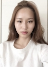 Double Eyelid Revision (Natural adhesion method+Ptosis correction) — Korea cost, reviews & before-after | MISOODA