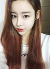 Eye surgery (Natural adhesion+ Ptosis correction) + Nasal bridge+Nasal tip — Korea cost, reviews & before-after | MISOODA