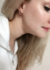 Hello everyone, I wanted to share my experience... — Korea cost, reviews & before-after | MISOODA