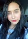 Rhinoplasty, Fat Grafting at BK Plastic Surgery — Korea cost, reviews & before-after | MISOODA