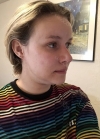 Hello everyone, I wanted to share my experience... — Korea cost, reviews & before-after | MISOODA