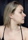 Hello everyone, I wanted to share my experience... — Korea cost, reviews & before-after | MISOODA