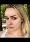 Hello everyone, I wanted to share my experience... — Korea cost, reviews & before-after | MISOODA