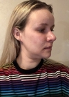 Hello everyone, I wanted to share my experience... — Korea cost, reviews & before-after | MISOODA