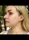 Hello everyone, I wanted to share my experience... — Korea cost, reviews & before-after | MISOODA