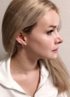 Hello everyone, I wanted to share my experience... — Korea cost, reviews & before-after | MISOODA