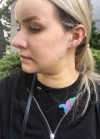 Hello everyone, I wanted to share my experience... — Korea cost, reviews & before-after | MISOODA