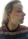 Hello everyone, I wanted to share my experience... — Korea cost, reviews & before-after | MISOODA