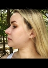 Hello everyone, I wanted to share my experience... — Korea cost, reviews & before-after | MISOODA