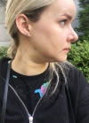Hello everyone, I wanted to share my experience... — Korea cost, reviews & before-after | MISOODA