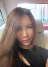Fat Grafting Surgery in BK Hospital Seoul Korea — Korea cost, reviews & before-after | MISOODA