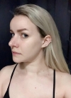 Hello everyone, I wanted to share my experience... — Korea cost, reviews & before-after | MISOODA