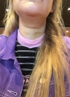Hello everyone, I wanted to share my experience... — Korea cost, reviews & before-after | MISOODA
