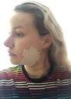 Hello everyone, I wanted to share my experience... — Korea cost, reviews & before-after | MISOODA