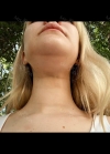 Hello everyone, I wanted to share my experience... — Korea cost, reviews & before-after | MISOODA