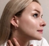 Hello everyone, I wanted to share my experience... — Korea cost, reviews & before-after | MISOODA