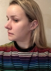 Hello everyone, I wanted to share my experience... — Korea cost, reviews & before-after | MISOODA