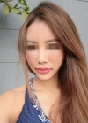 Fat Grafting Surgery in BK Hospital Seoul Korea — Korea cost, reviews & before-after | MISOODA