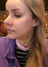 Hello everyone, I wanted to share my experience... — Korea cost, reviews & before-after | MISOODA