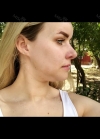 Hello everyone, I wanted to share my experience... — Korea cost, reviews & before-after | MISOODA