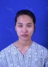 Rhinoplasty, Fat Grafting at BK Plastic Surgery — Korea cost, reviews & before-after | MISOODA