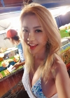 Breast Augmentation — Korea cost, reviews & before-after | MISOODA