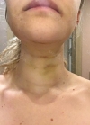 Hello everyone, I wanted to share my experience... — Korea cost, reviews & before-after | MISOODA