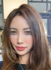 Fat Grafting Surgery in BK Hospital Seoul Korea — Korea cost, reviews & before-after | MISOODA