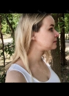 Hello everyone, I wanted to share my experience... — Korea cost, reviews & before-after | MISOODA