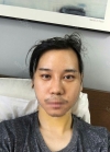 Double Eyelid Surgery, Chin Implant, Rhinoplasty — Korea cost, reviews & before-after | MISOODA