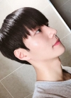 Nose surgery 3 months — Korea cost, reviews & before-after | MISOODA